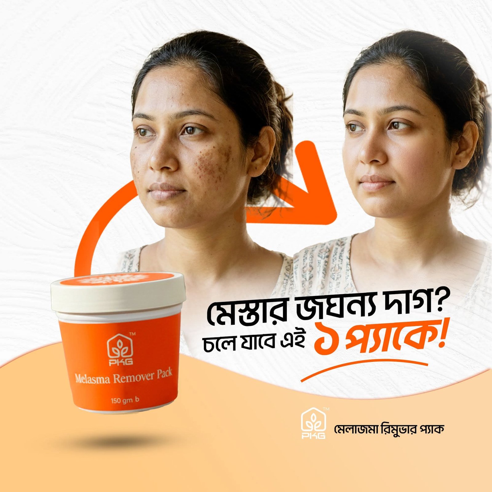 Melasma Remover Pack